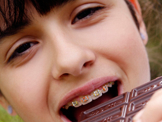 Clínica Dental Dra. Felisa Muñoz Plaza niño comiendo chocolate